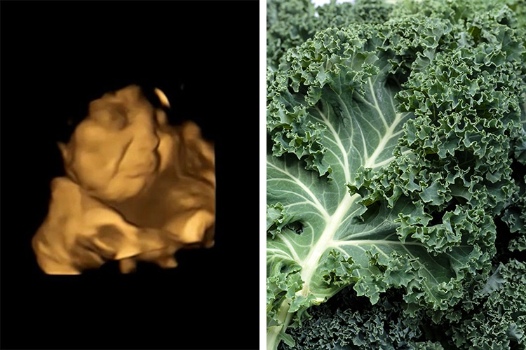 The Taste of Kale Makes Unborn Babies Grimace