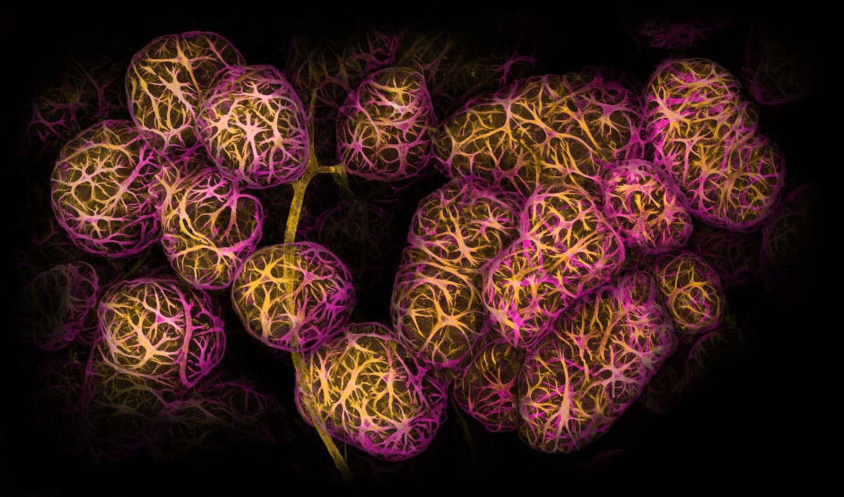 Breast tissue showing contractile myoepithelial cells wrapped around milk-producing alveoli