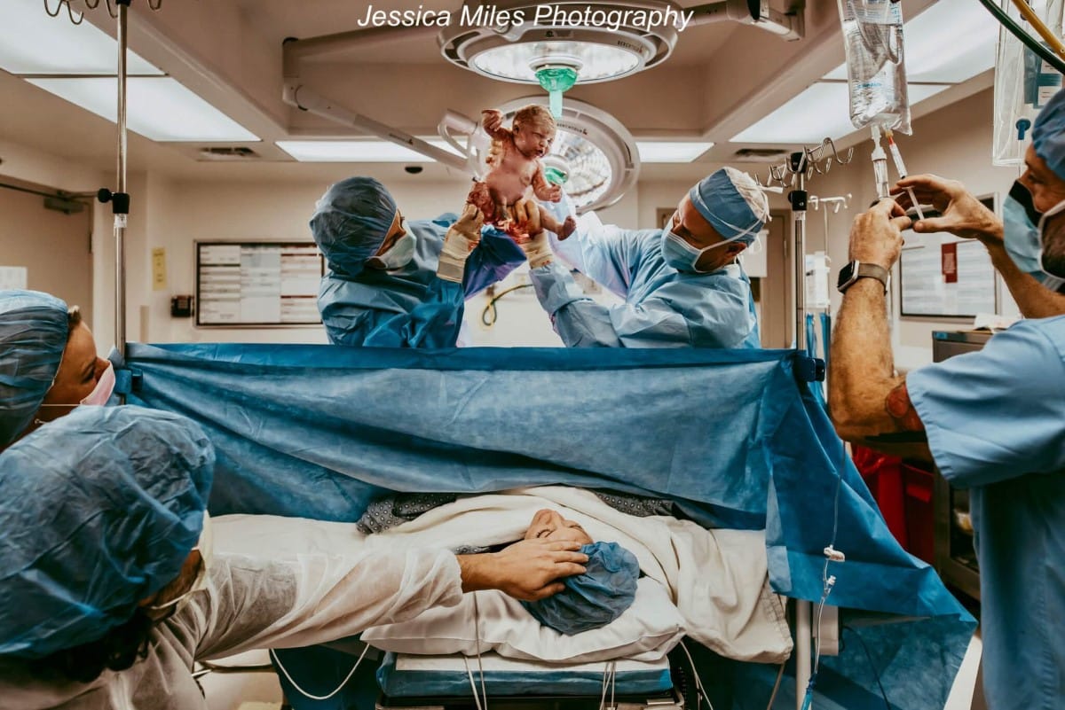 Physicians holding baby up over the drape to reveal to parents 