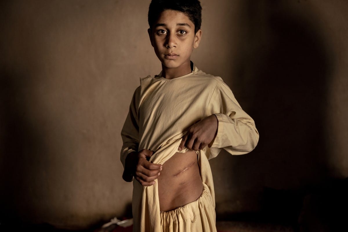 Portrait of an Afgan teenager who sold his kidney