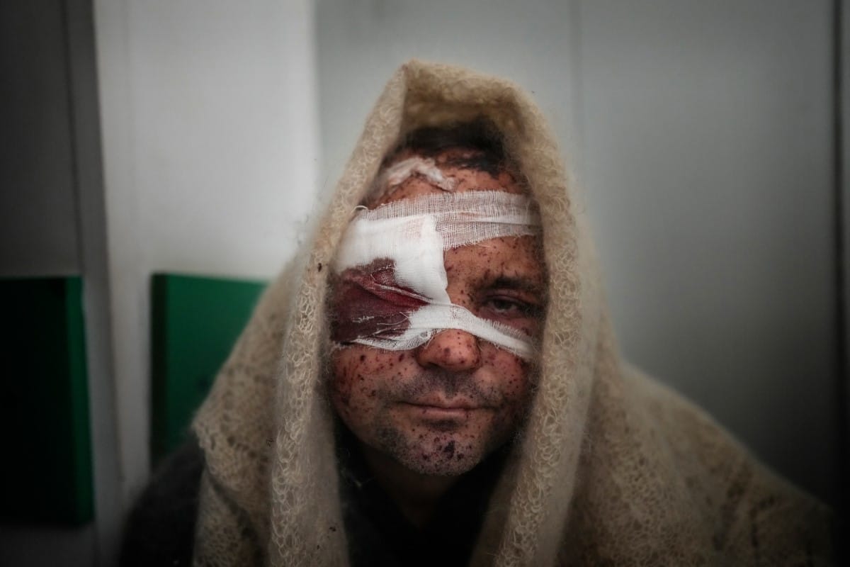 Man injured by shelling in Ukraine
