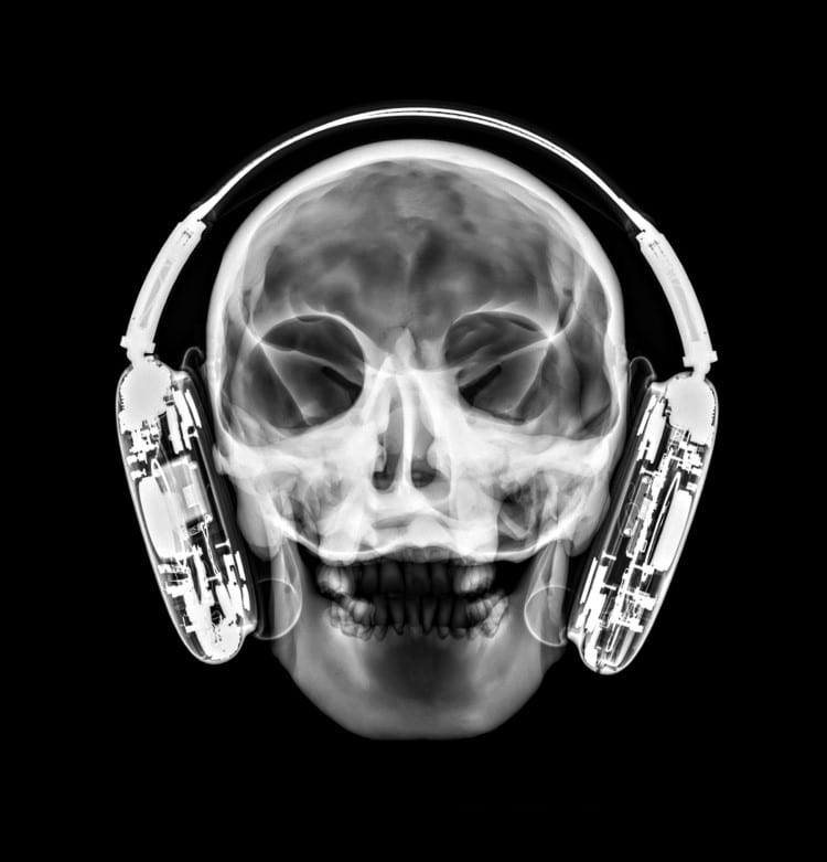 X-ray of person wearing AirPods Max