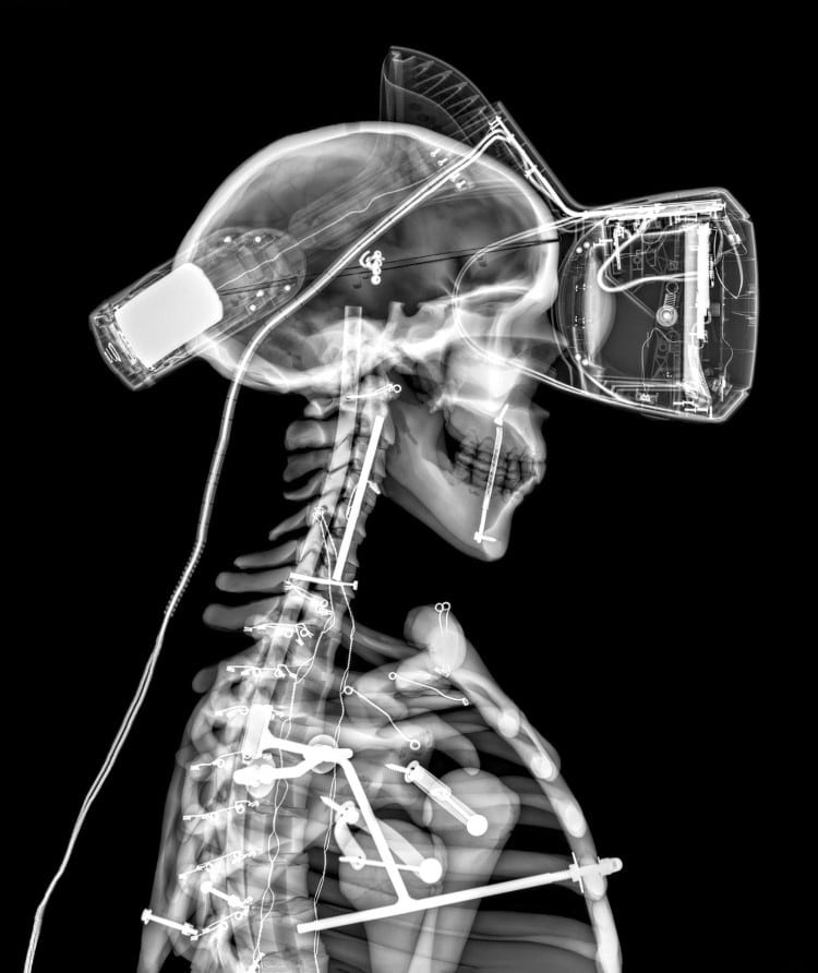 X-ray of a man wearing virtual reality glasses