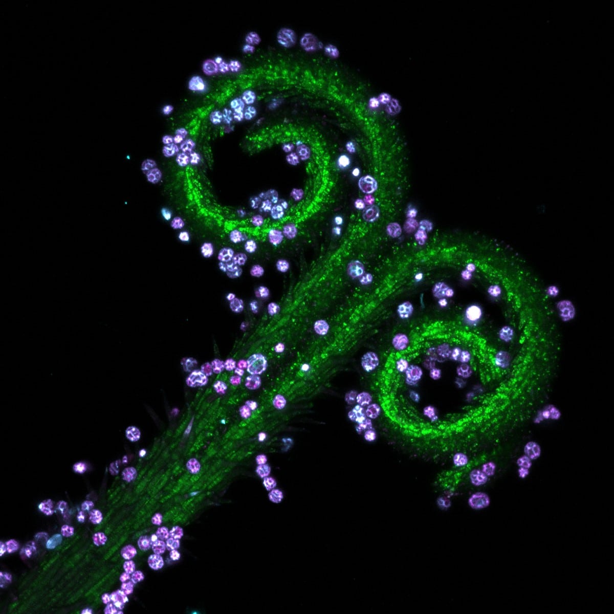 Pistils of dandelion were collected and made into slide samples. Different fluorescence patterns of its parts were observed using confocal microscopy.