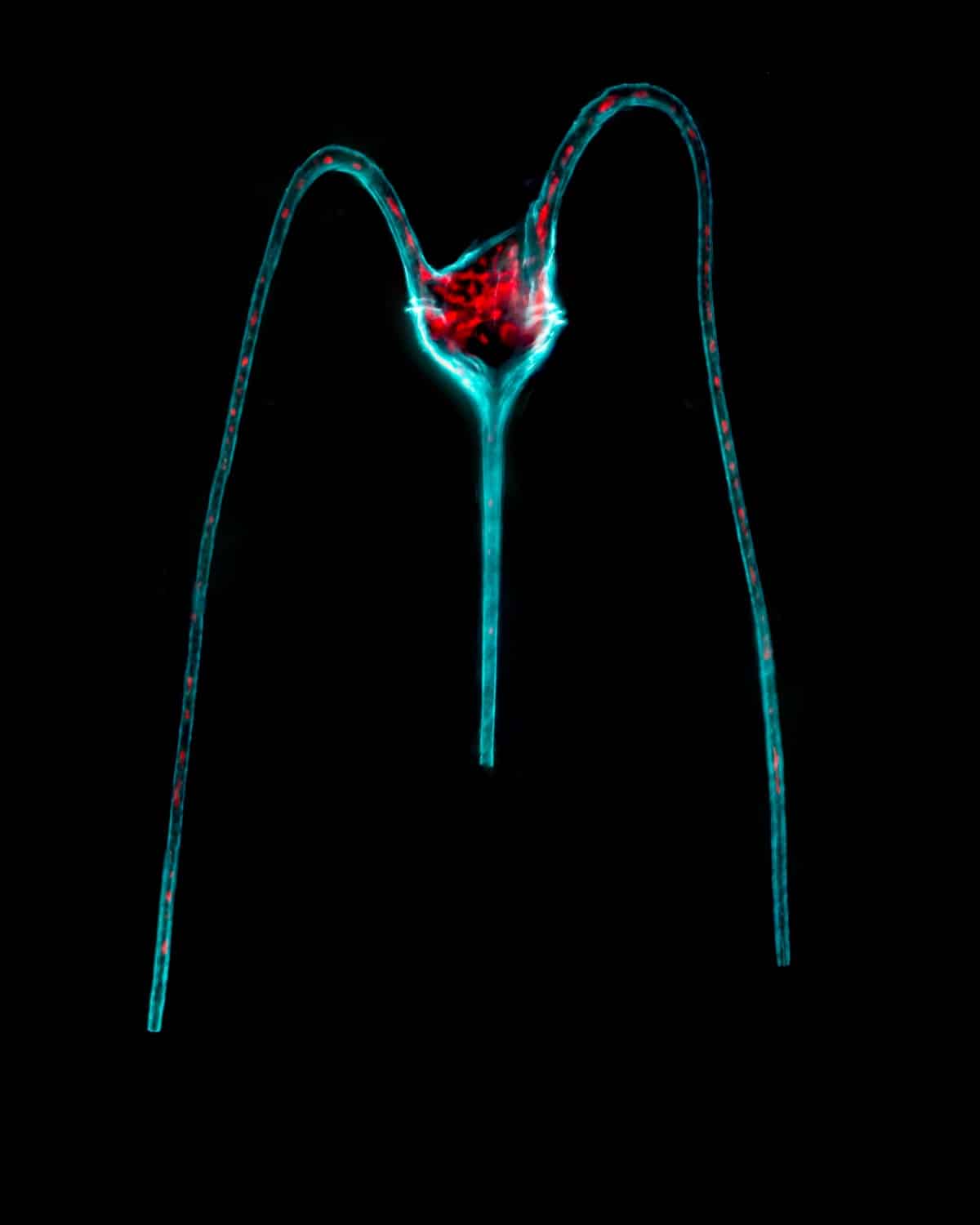 Tripos macroceros. A unicellular microalga with three horns.