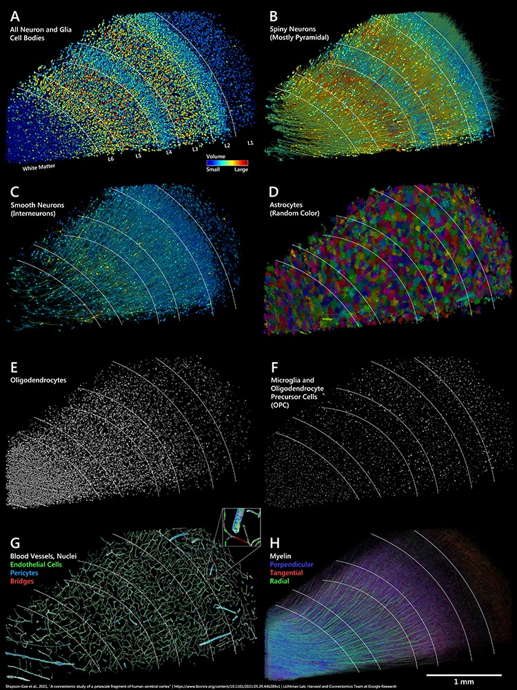 Distribution of neurons, blood vessels and myelin in brain map sample.