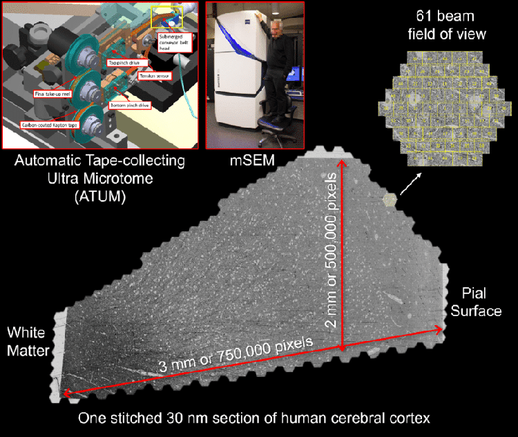 Image acquisition of human brain sample