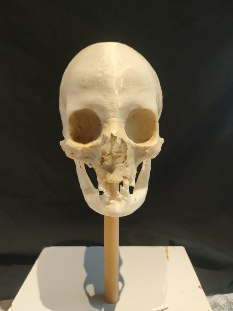3D Skull of Mummy Based on CT Scans