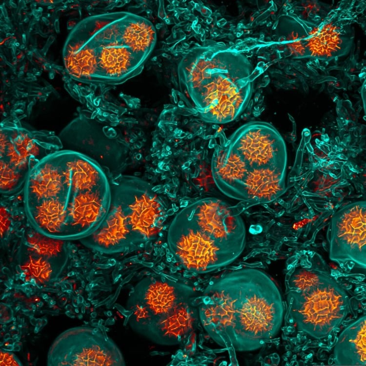 Confocal of black truffle spores