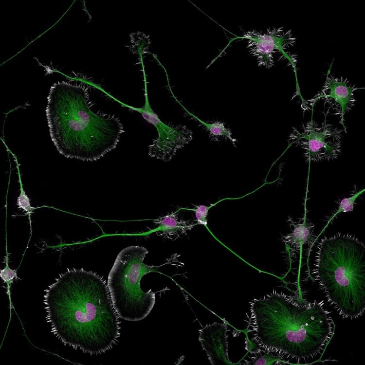 Differentiated mouse brain tumor cells photomicrography