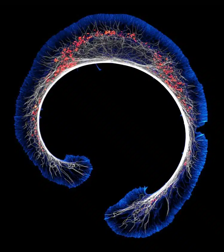 Photomicrography of a early stage of mouse glioblastoma cell differentiation