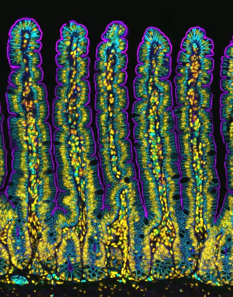 Fluorescence of a mouse small intestine