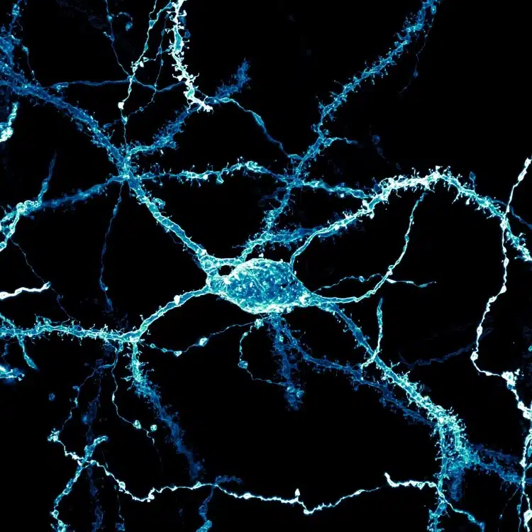 Confocal of a neuron densely covered in dendritic spines from the striatum of an adult rat brain