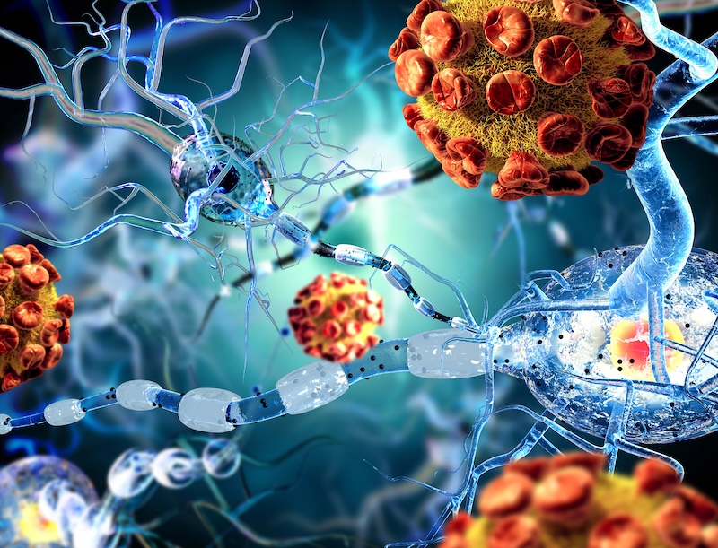 first successful treatment of Huntington's disease