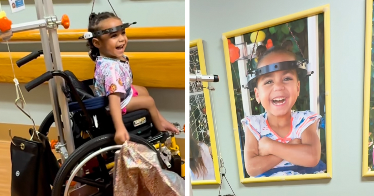 Hospital’s ‘Halo Hall of Fame’ Celebrates Kids Undergoing Halo Traction