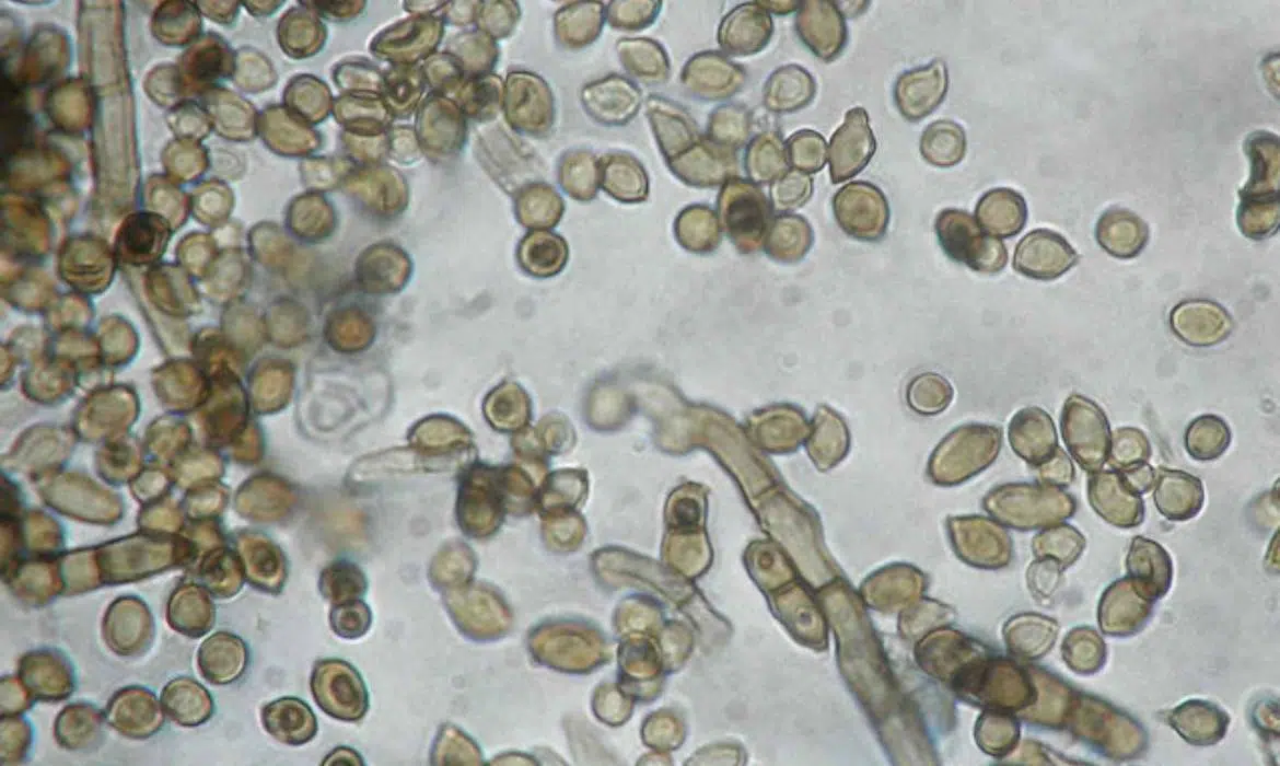 Chernobyl Black Fungus