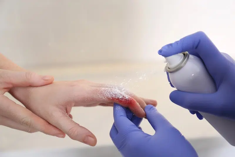 South Korean Scientists Create Spray-On Powder That Stops Severe Bleeding in One Second