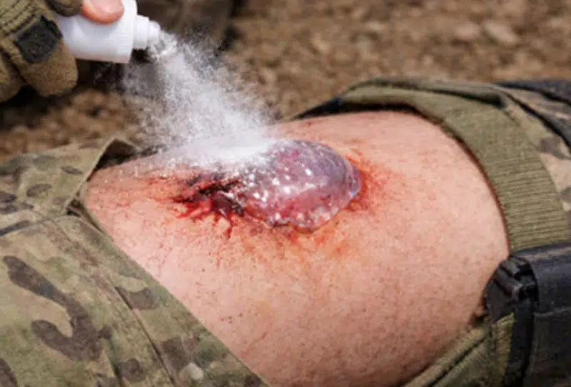 Spray being applied to a wound