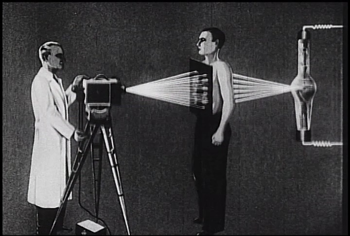 &ldquo;Moving X rays,&rdquo; c. 1938, prod. by Nicholas Kaufmann. Written and directed by Martin Rikli, technical advisor Robert Janker. Digital video