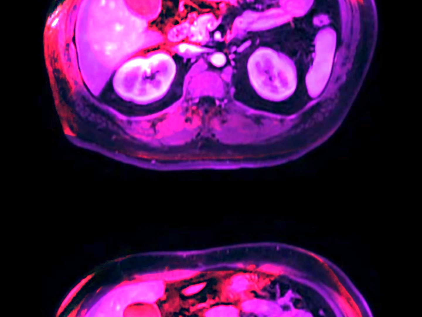 Anna Kipervaser, &ldquo;in ocula oculorum,&rdquo; 2021. Digital video