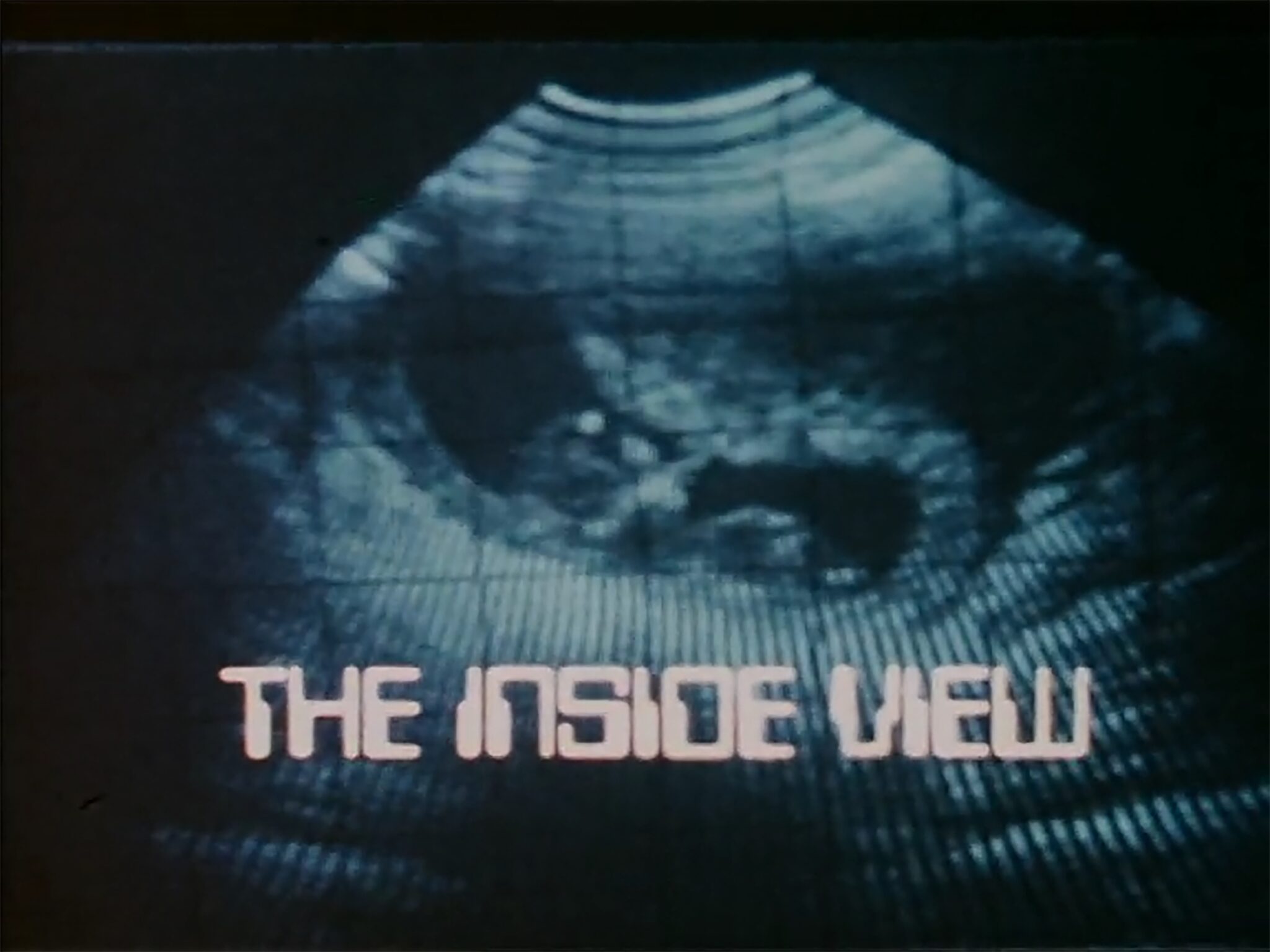 London Television Service, &ldquo;The Inside View,&rdquo; 1979, dir. by Edward Poulter