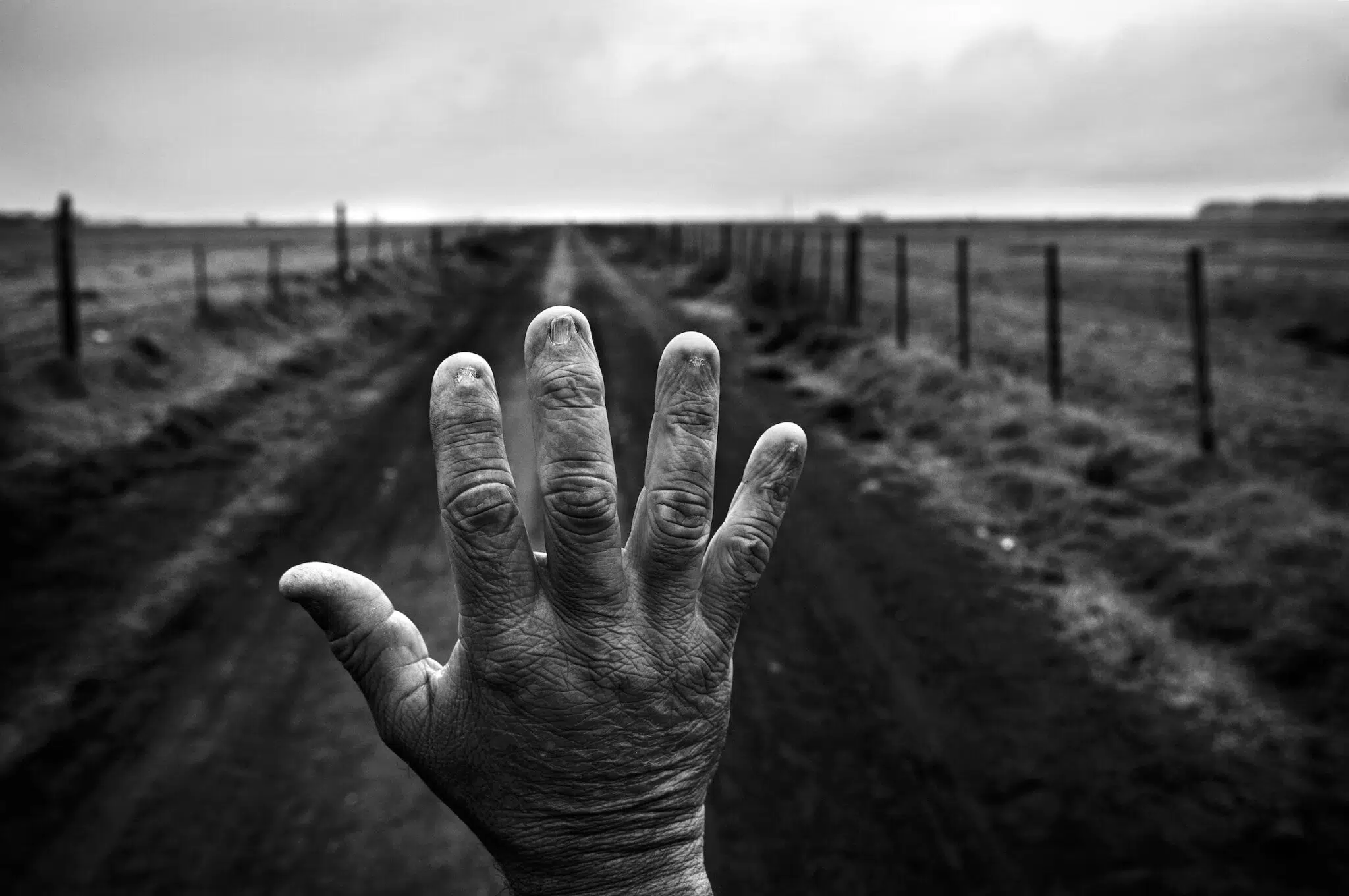 Pablo E. Piovano, &ldquo;The Human Cost of Agrotoxins,&rdquo; for the Manuel Rivera-Ortiz Foundation and Philip Jones Griffiths Foundation. Former land applicator Alfredo Cer&aacute;n shows his burned fingernails. After years of mixing chemical products without adequate protection, he developed non-alcoholic cirrhosis and underwent a liver transplant. Cordoba, Argentina, September 23, 2015.