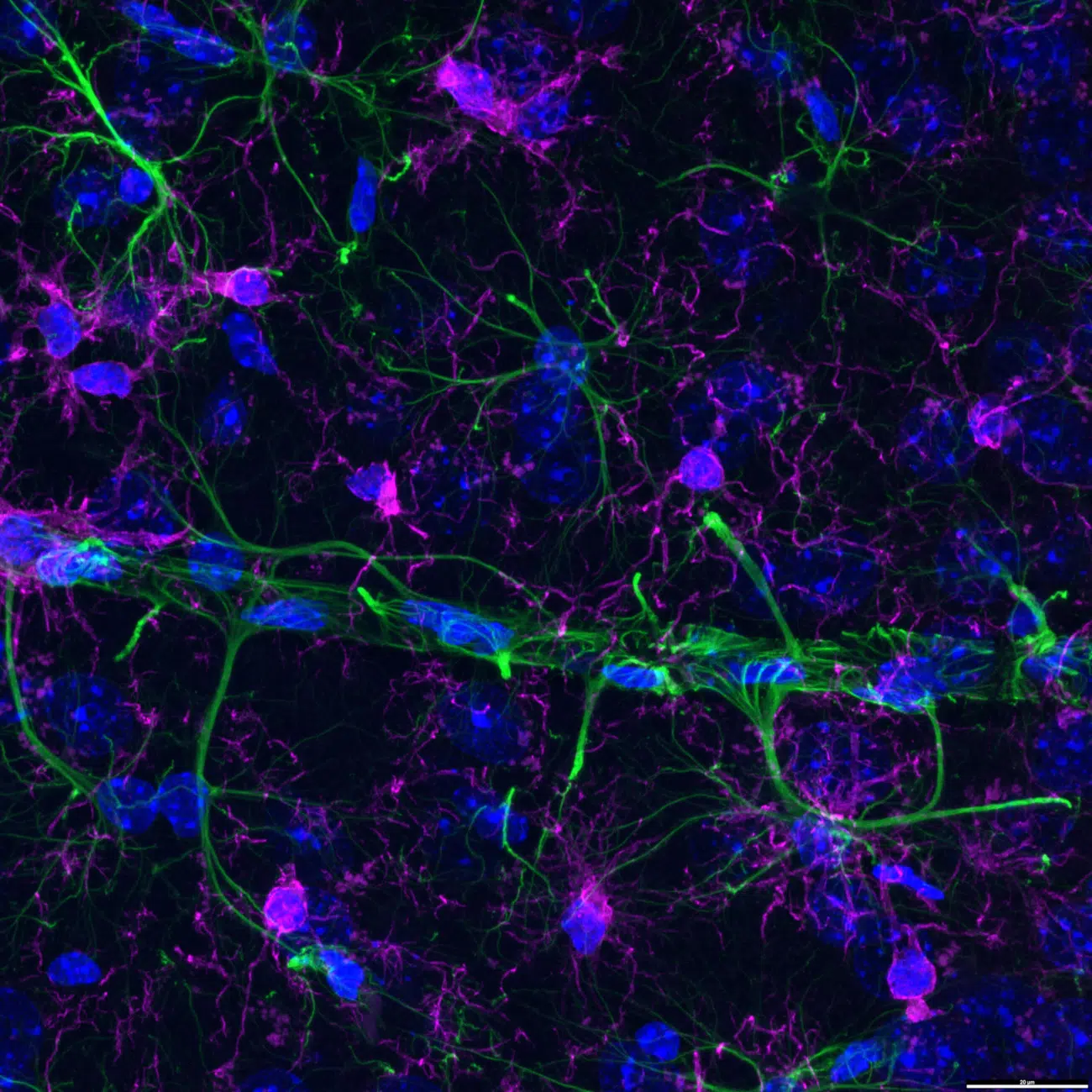 Honorable Mention. Fluorescent immunostained brain tissue from an Alzheimer’s disease mouse model. Captured by Bettina Rákóczi (Hungary).