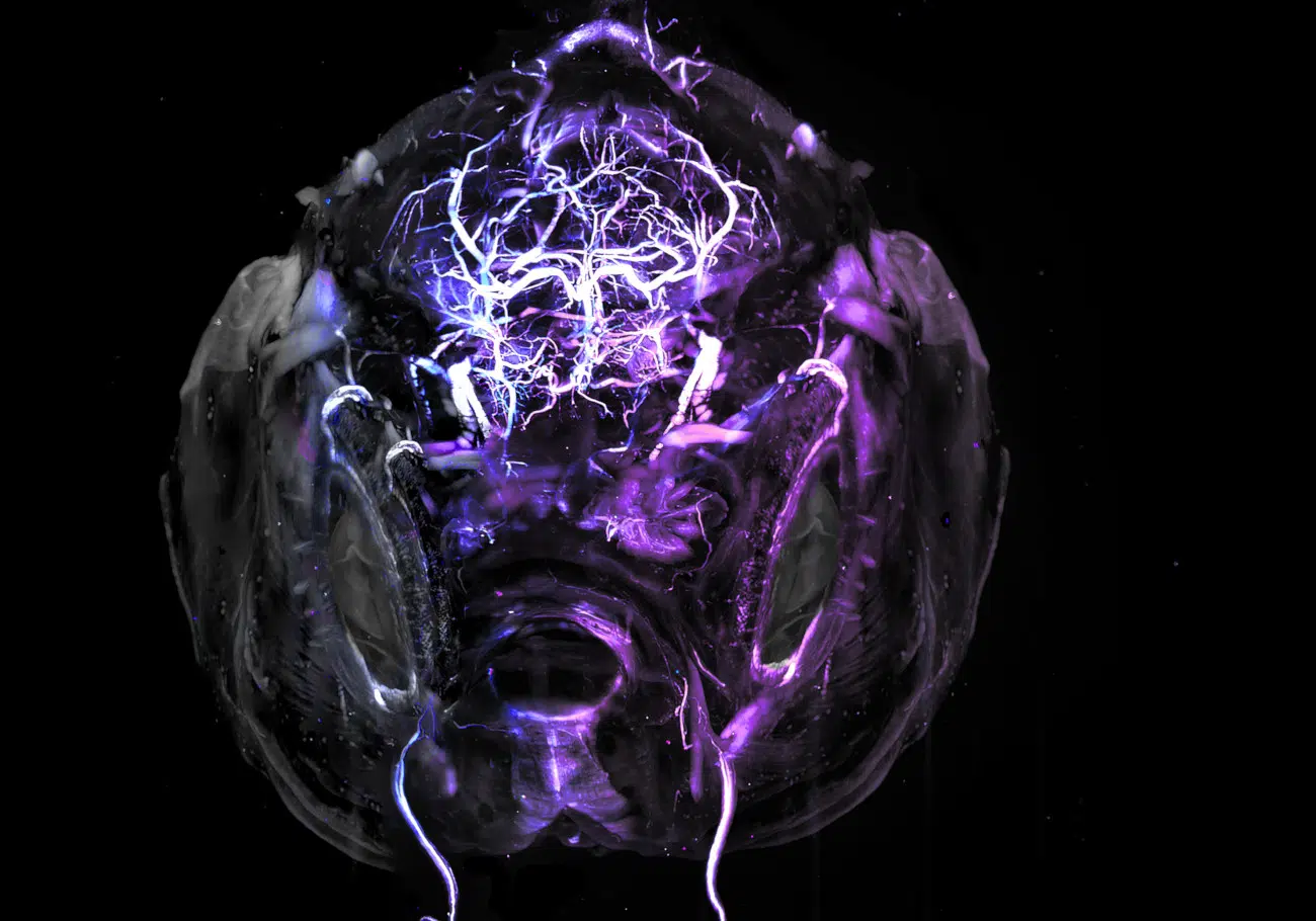 Honorable Mention. Adult zebrafish brain. Captured by Hannah Somers (United States).