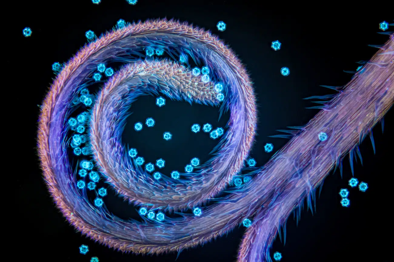 Regional Award Winners: Europe, the Middle East, and Africa. Stigma of chicory with pollen grains. Captured by Gerd Günther (Germany).