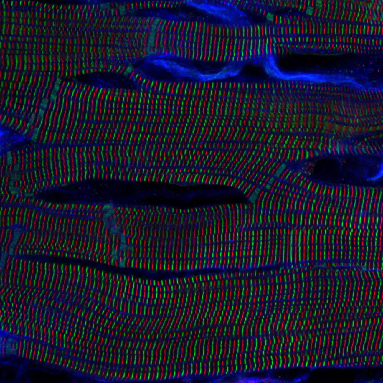 Regional Award Winners: Asia-Pacific. Sarcomere structures within cardiomyocytes in a rat heart. Captured by Kentaro Mochizuki (Japan).