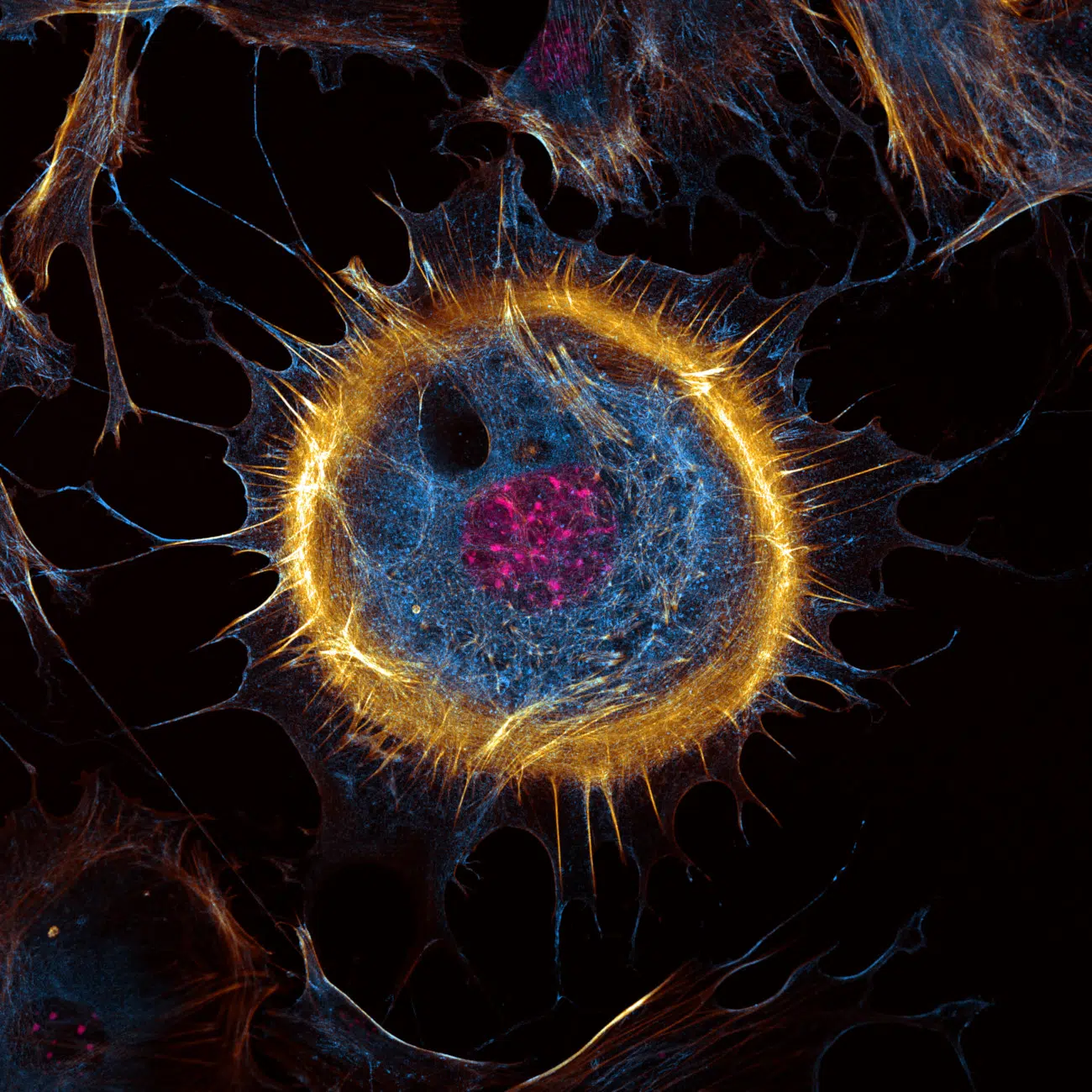 Honorable Mention. Mouse embryonic fibroblast. Captured by Joe McKellar (France).