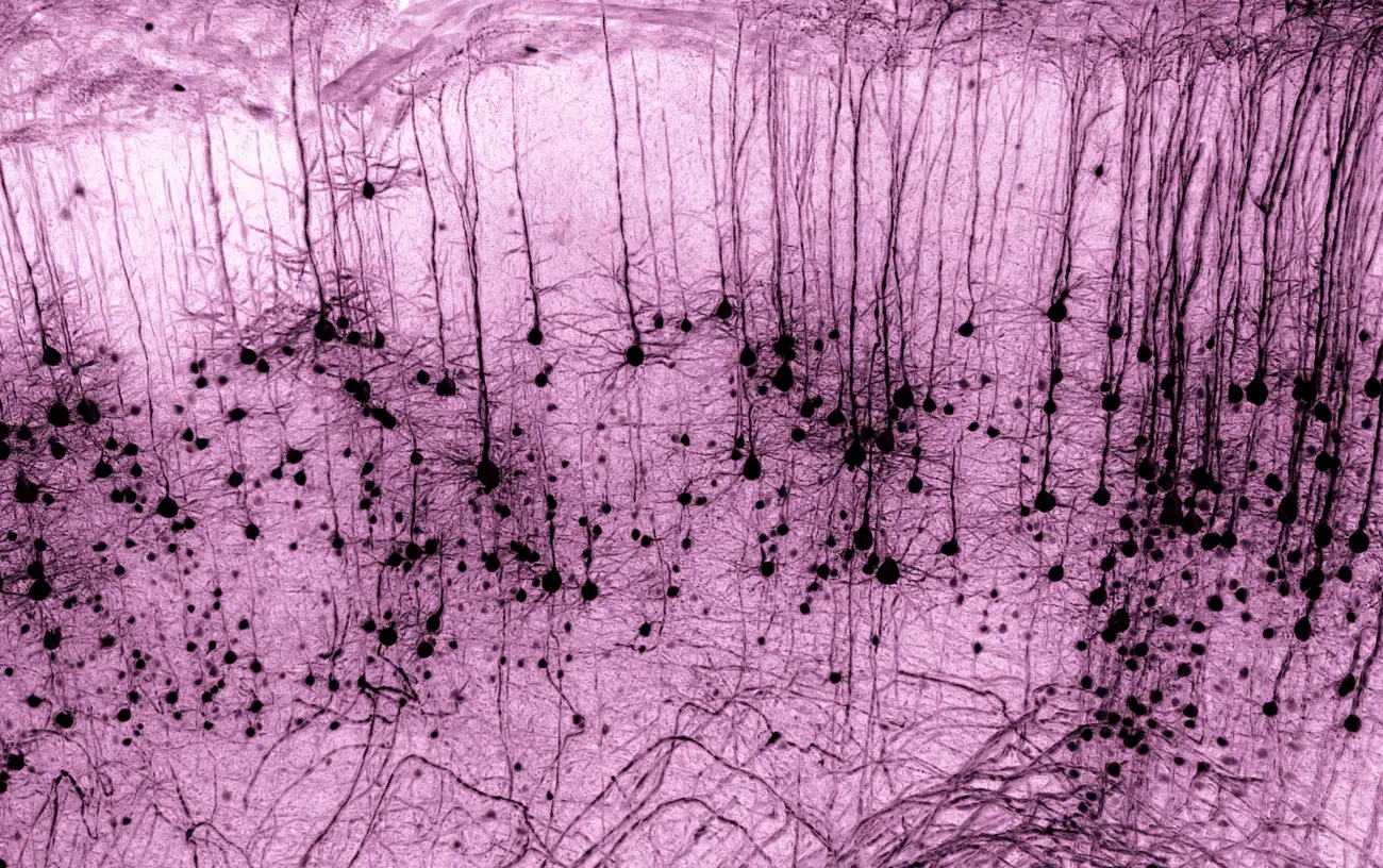 Honorable Mention. GFP-positive Thy1 neuron in a tissue-cleared mouse brain. Captured by Marko Pende (Austria).