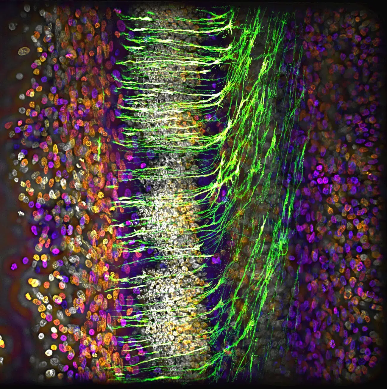 Honorable Mention. Commissural axons navigating across the midline of a developing central nervous system in a chick embryo. Captured by Alexandre Dumoulin (Switzerland).