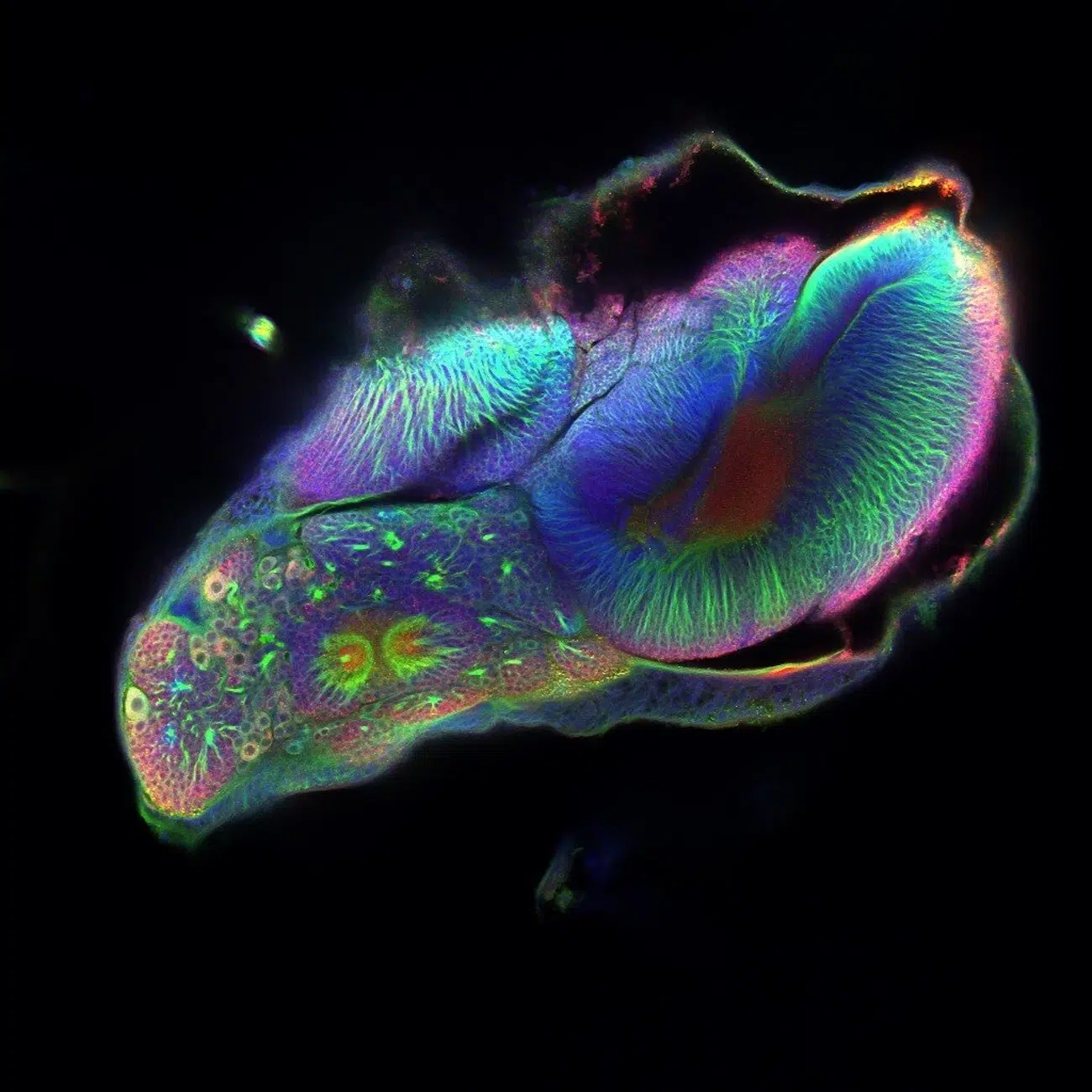 MRI of butterfly.