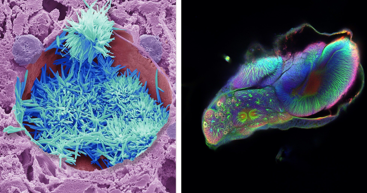 Free-To-Enter Wellcome Photography Contest Offers $70,000 in Prizes