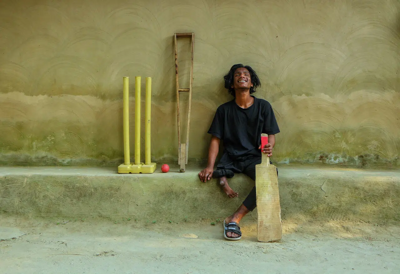 Man with one leg sitting with his cricket equipment