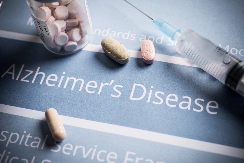 Alzheimer’s Trail Treatment Drug Trontinemab