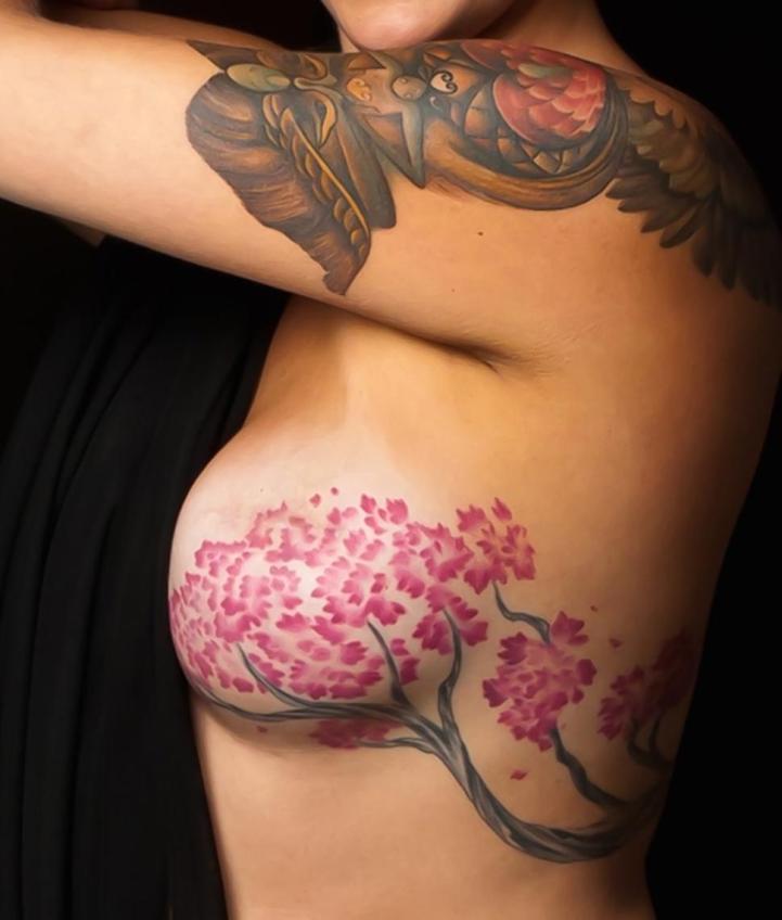 Breast cancer survivor's photo of tattoos across mastectomy scars