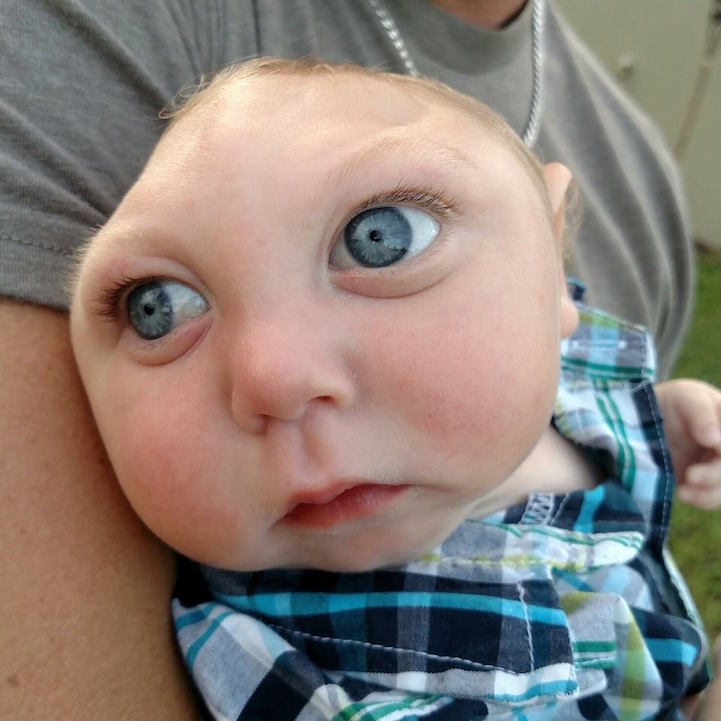 baby with no skull jaxon buell