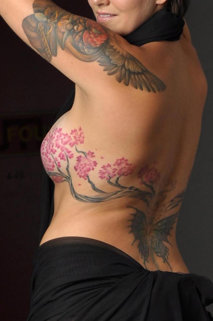 Breast Cancer Survivor Turns Mastectomy Scars Into Beautiful Tattoos Of